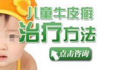 孩子患上了牛皮癣现在整天闷闷不乐可如何是好