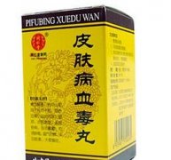 请问牛皮癣患者吃血毒丸有效吗